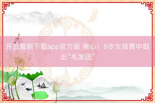 开云最新下载app官方版 揪心！6岁女孩胃中取出“毛发团”